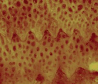 Sidewinder snake microstructures