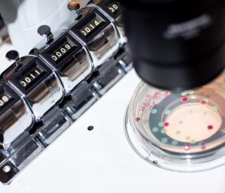 Colonies of competing bacteria